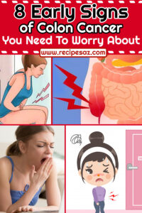 8 Early Signs of Colon Cancer, You Need To Worry About - Recipes A to Z